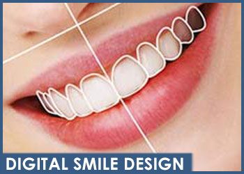 dentista-magenta-esseti88-digital-smile-design