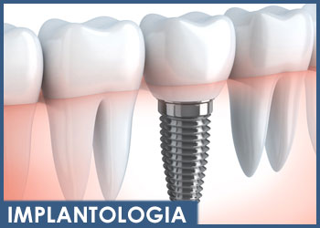 dentista-magenta-esseti88-implantologia-dentale