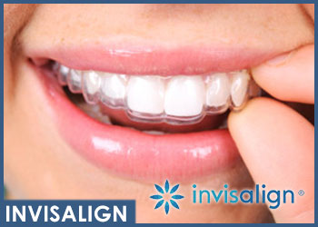 dentista-magenta-esseti88-punto-dentista-invisalign