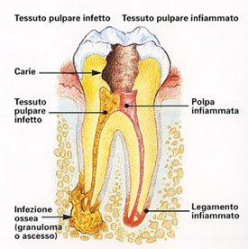 studio-dentistico-magenta-esseti-88-endodonzia-02